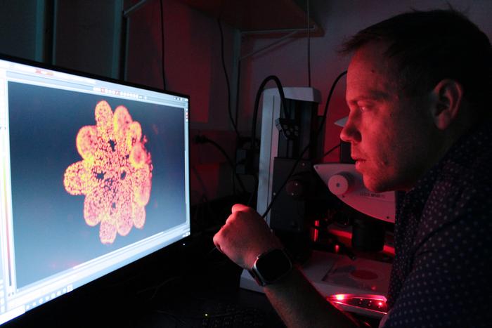 Coral under the microscope