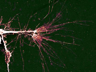 Neural Cells on Textured Semiconductor Material