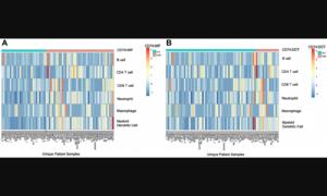 Prognostic and therapeutic insights into MIF, DDT, and CD74 in melanoma