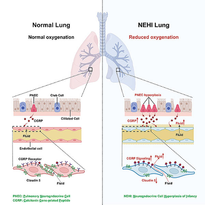 CGRP Graphic