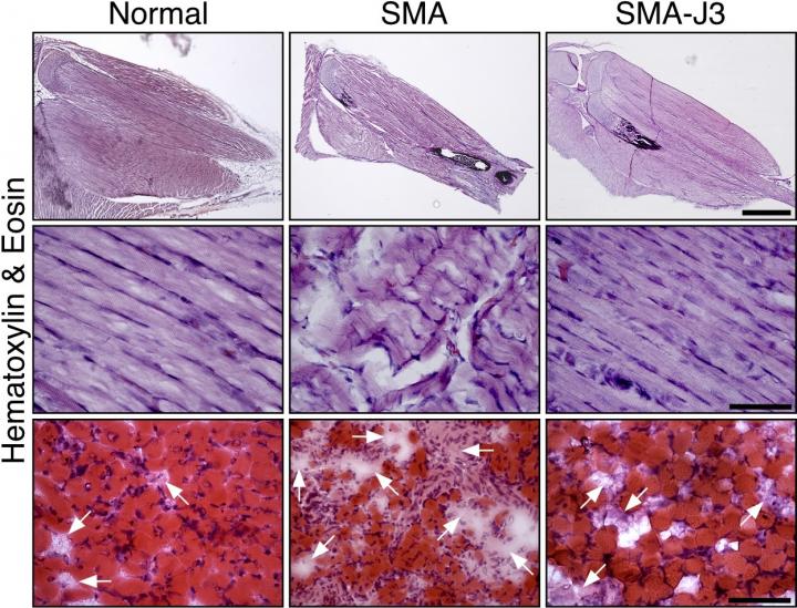 JNK3 Inhibition Reduces Muscle Degeneration in Mice with Spinal Muscular Atrophy
