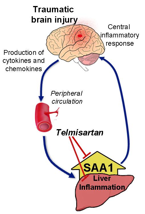TBI Triggers Liver to Produce Protein Tied to Inflammation; Hypertension Drug Blocks It