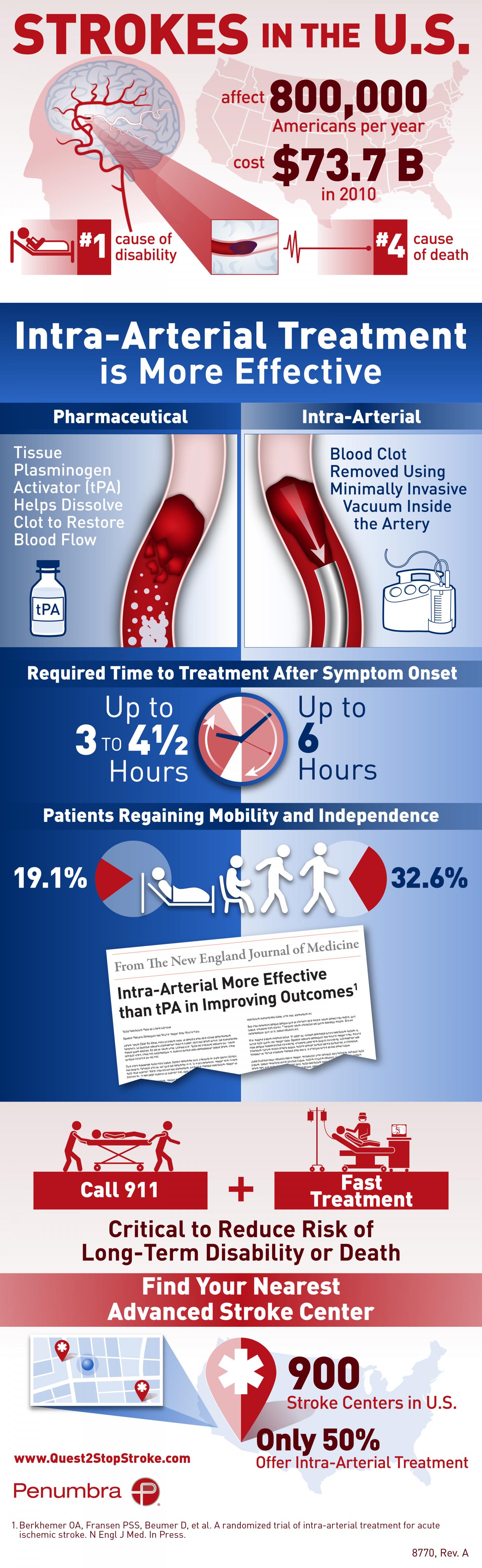 Infographic: Life-Saving Facts about Stroke Treatment