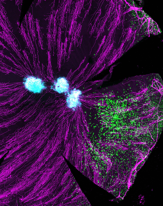 World-First Discovery of Cornea T Cells Protecting Eyes from Viral Infections