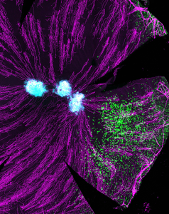 TRM cells in cornea