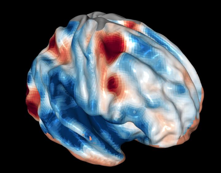 An fMRI Brain Image Shows Frontal Cortex Activity during Vision Tasks