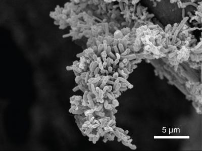 Exeoelectrogenic Microbe (1 of 2)