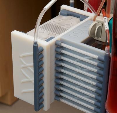 Wyss Institute's Spleen-on-a-Chip Microdevice