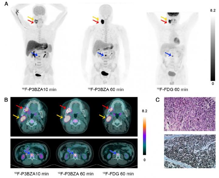 Sample Images of a Melanoma Patient