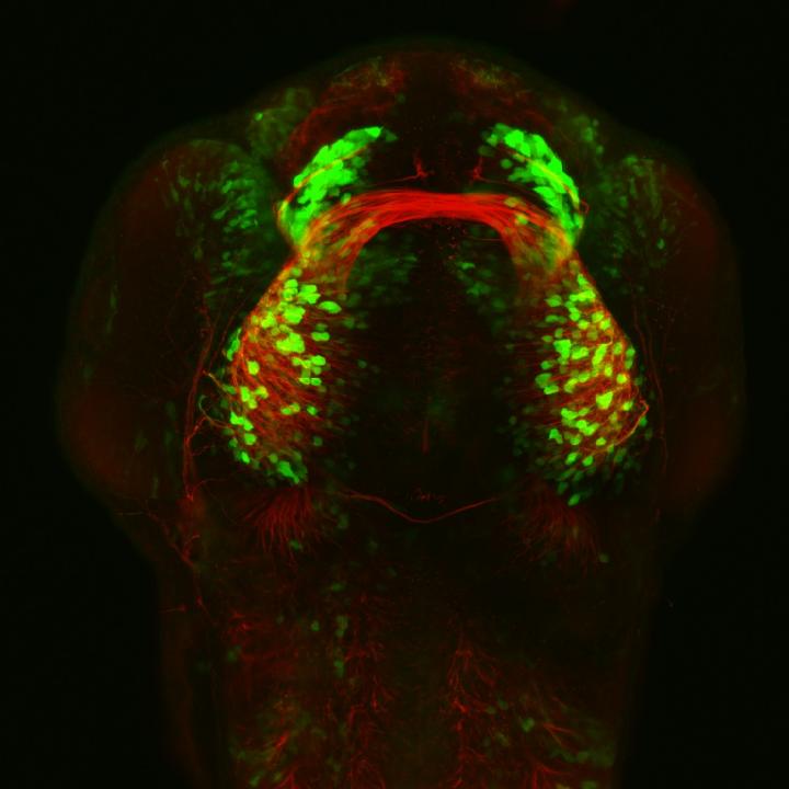 Neurons and neuronal connections