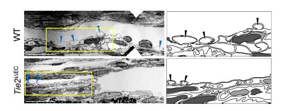 Schlemm's Canal Vacuoles