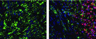 T Cells Before and After Treatment