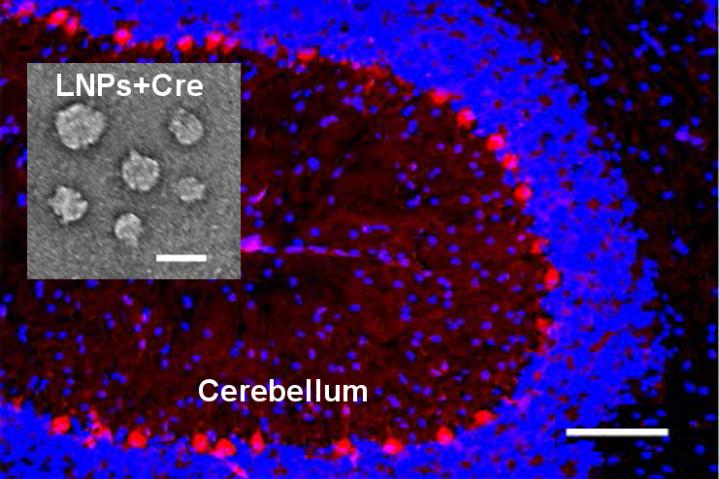 In vivo delivery of Cre-recombinase (gene editing protein) into the mouse brain