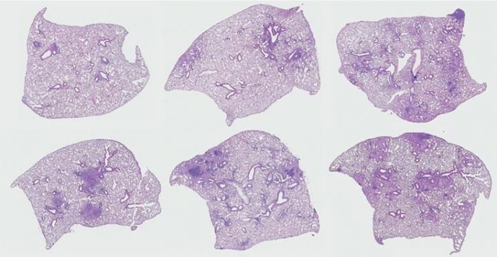 Lung Lining Cells