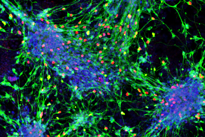 Sensory interneurons