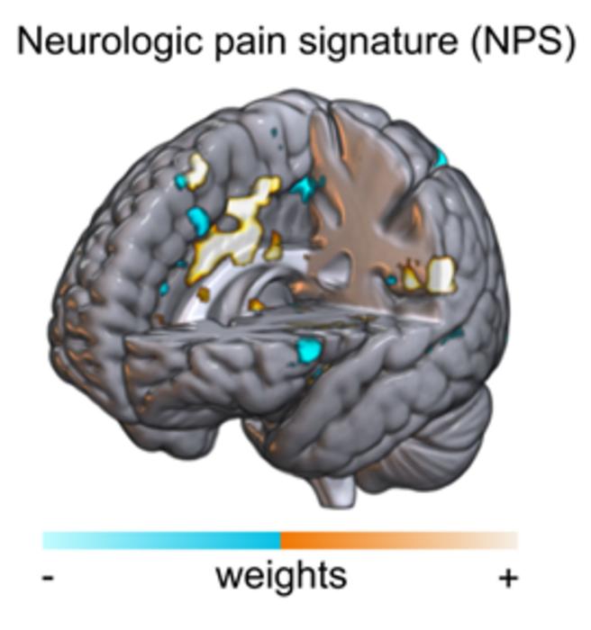 Brain response image