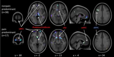 MRI Shows Structural Brain Changes