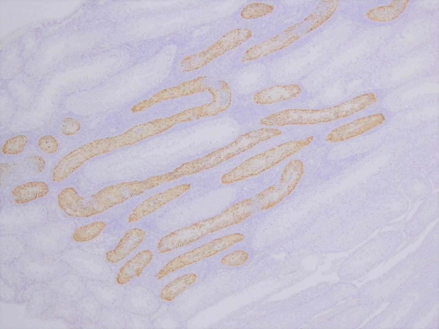 Are American Zika strains more virulent than Pacific and Asian strains?