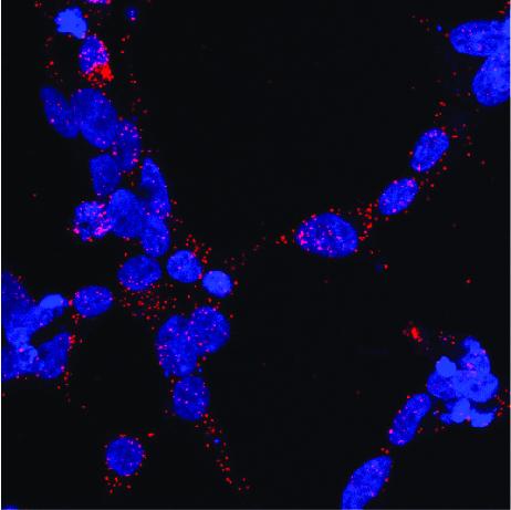 Interaction of the Androgen Receptor and Chaperone Hsp70