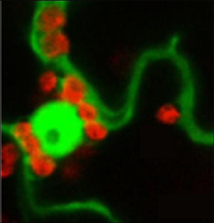 Chloroplasts Associated with Nucleus