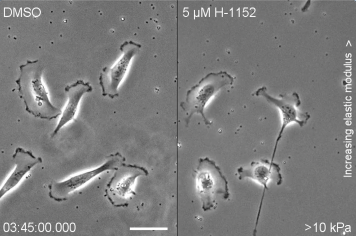 Cells moving around