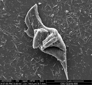 Electron microscope image of micro and nano tire particles