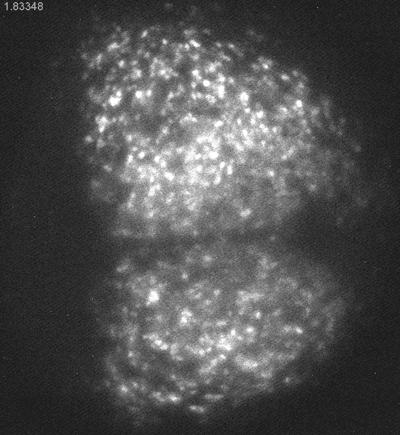 Resynchronization of Neurons
