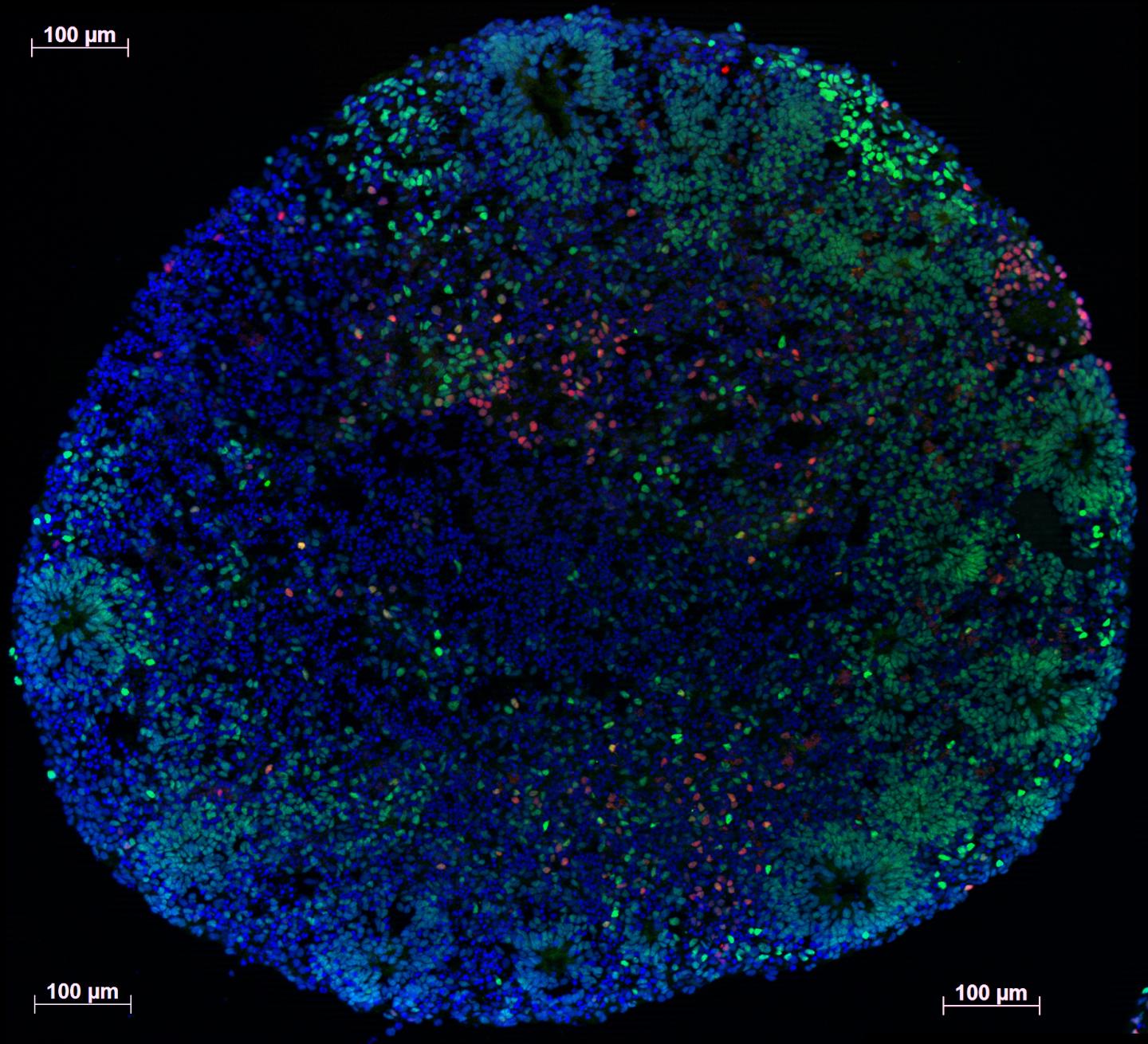 Illuminating the Brain Architecture of Neuropsychiatric Risk: The Latest from PsychENCODE (6 of 6)