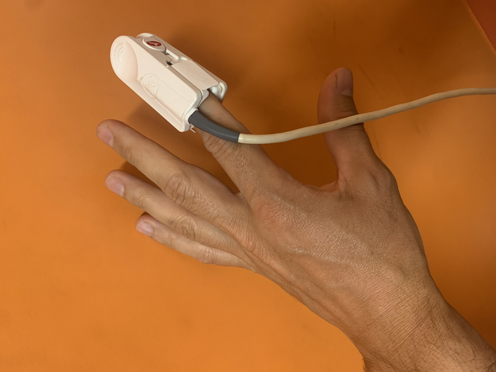 Test for carbon monoxide poisoning is unrelia EurekAlert!