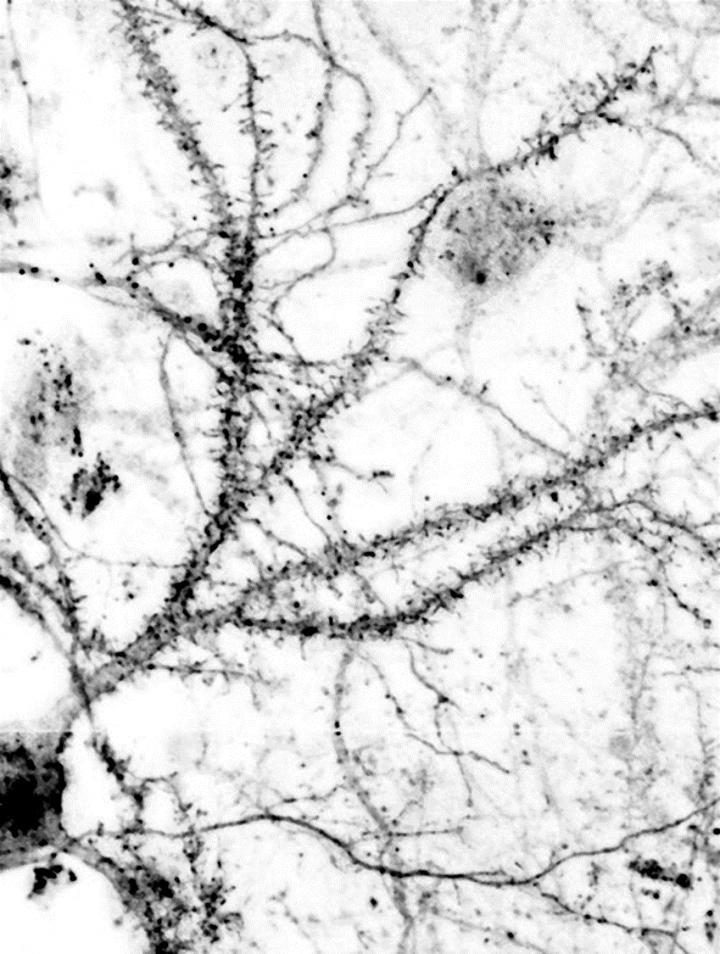 The Adaptor Protein NOS1AP in a Microscopic Image