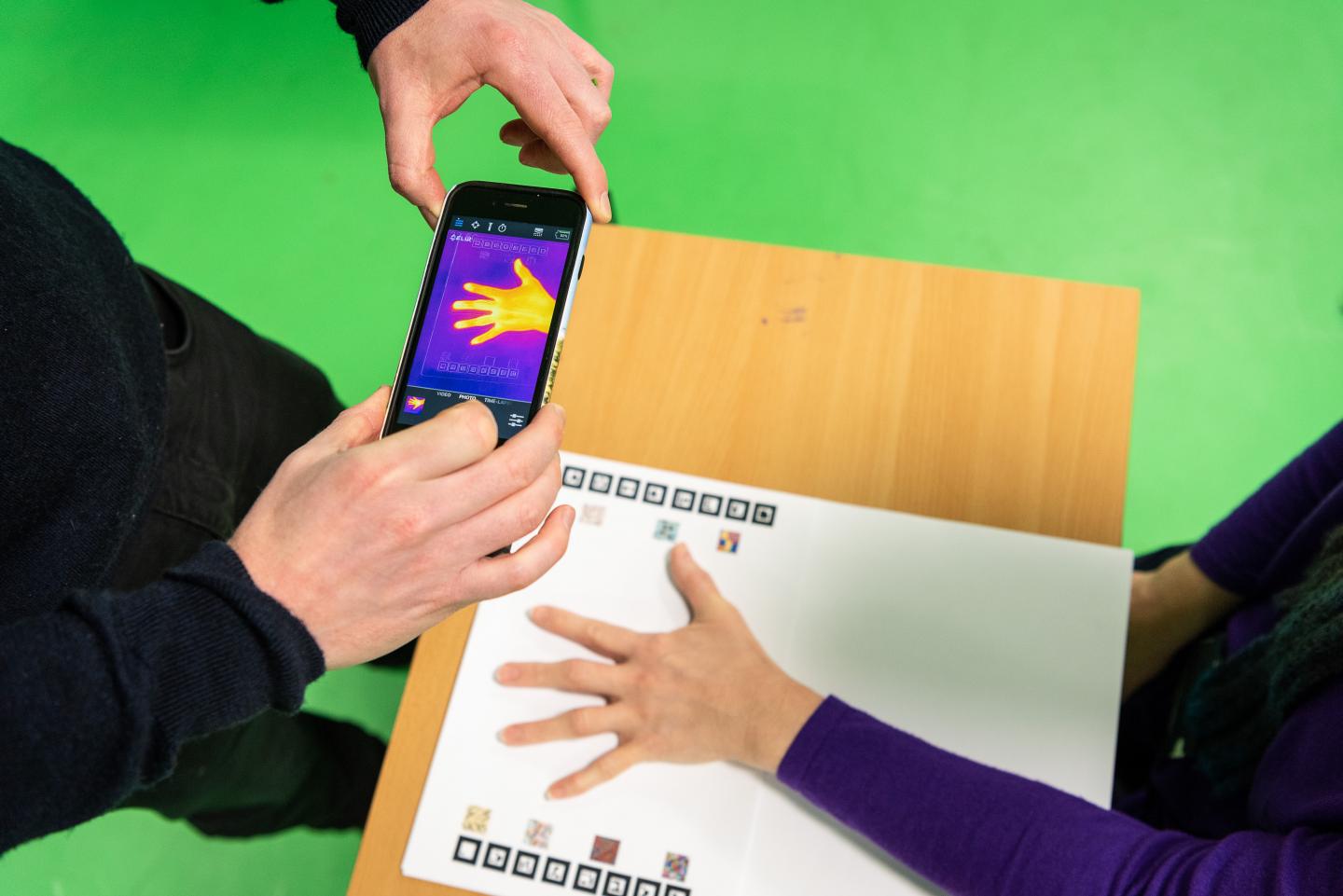 Thermal Imaging of Arthritis Patient