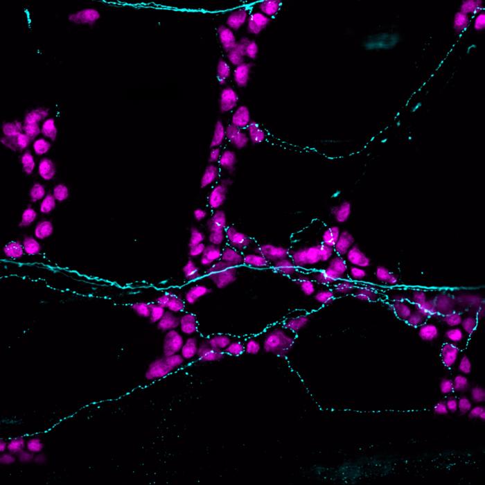 PIEZO2 Receptors