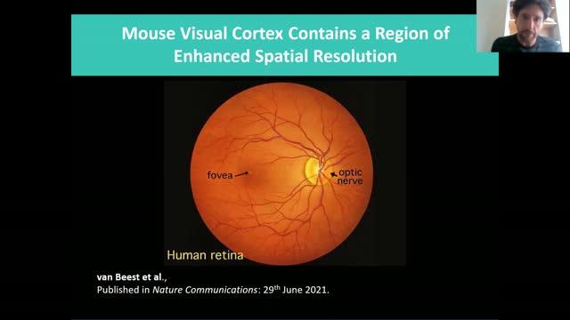 Mouse visual cortex contains a region of enhanced spatial resolution