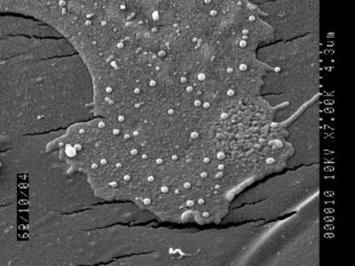 Cancer Nanotechnology