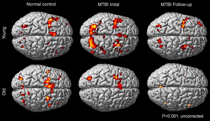 Different Working Memory Patterns