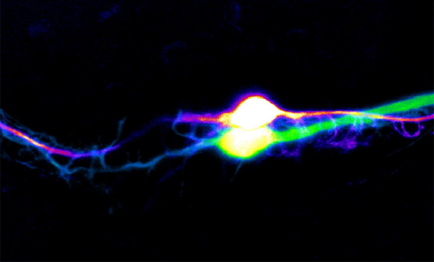 Two Neurons Involved in the Control of Feeding Behavior