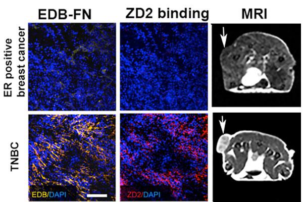 Targeted Contrast Agent for Breast Cancer Imaging