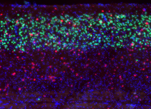 Visual cortex brain slice