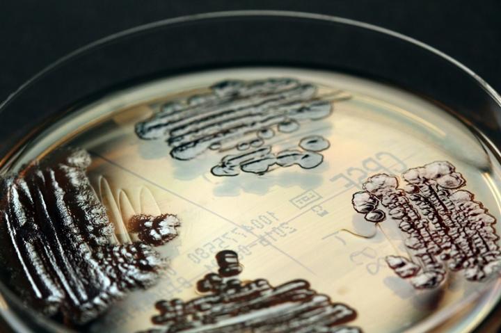 Keeping An Eye on the Pathogens: Multidrug-Resistant <i>Enterobacteriaceae</i> Shown in a Petri Dish