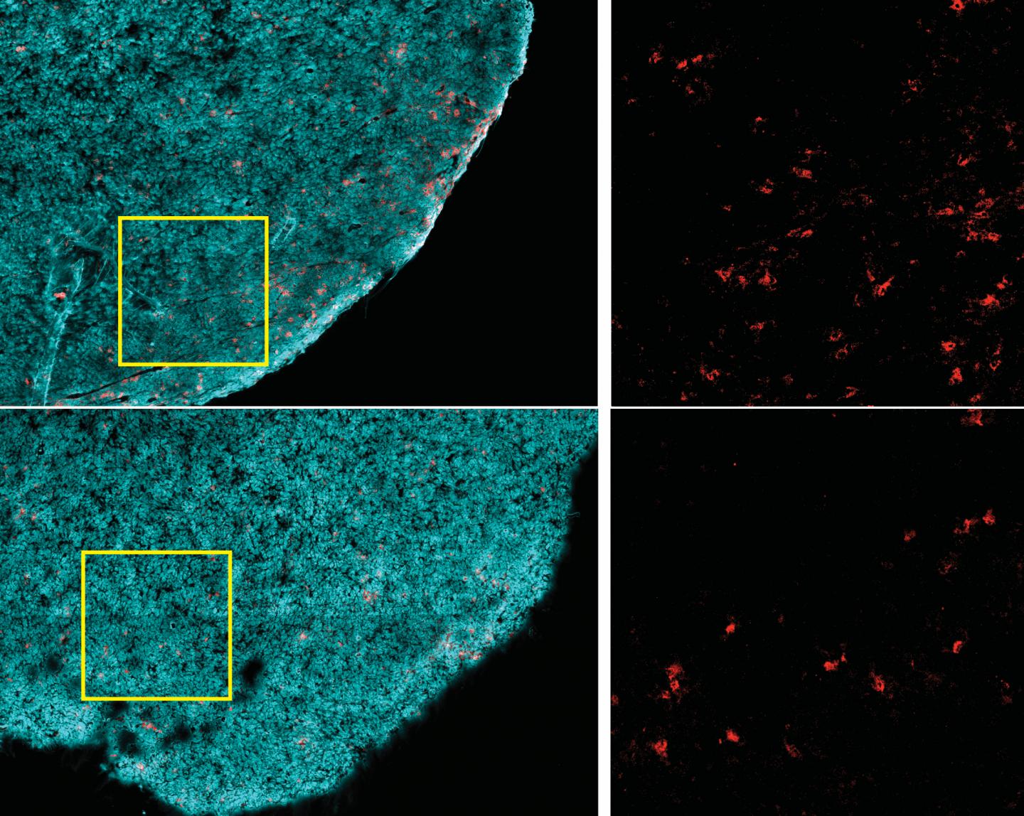 Obese vs nonobese tumors
