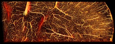Complex Network of Blood Vessels in the Mouse Brain