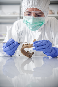 Microbial DNA is extracted from ancient dental calculus