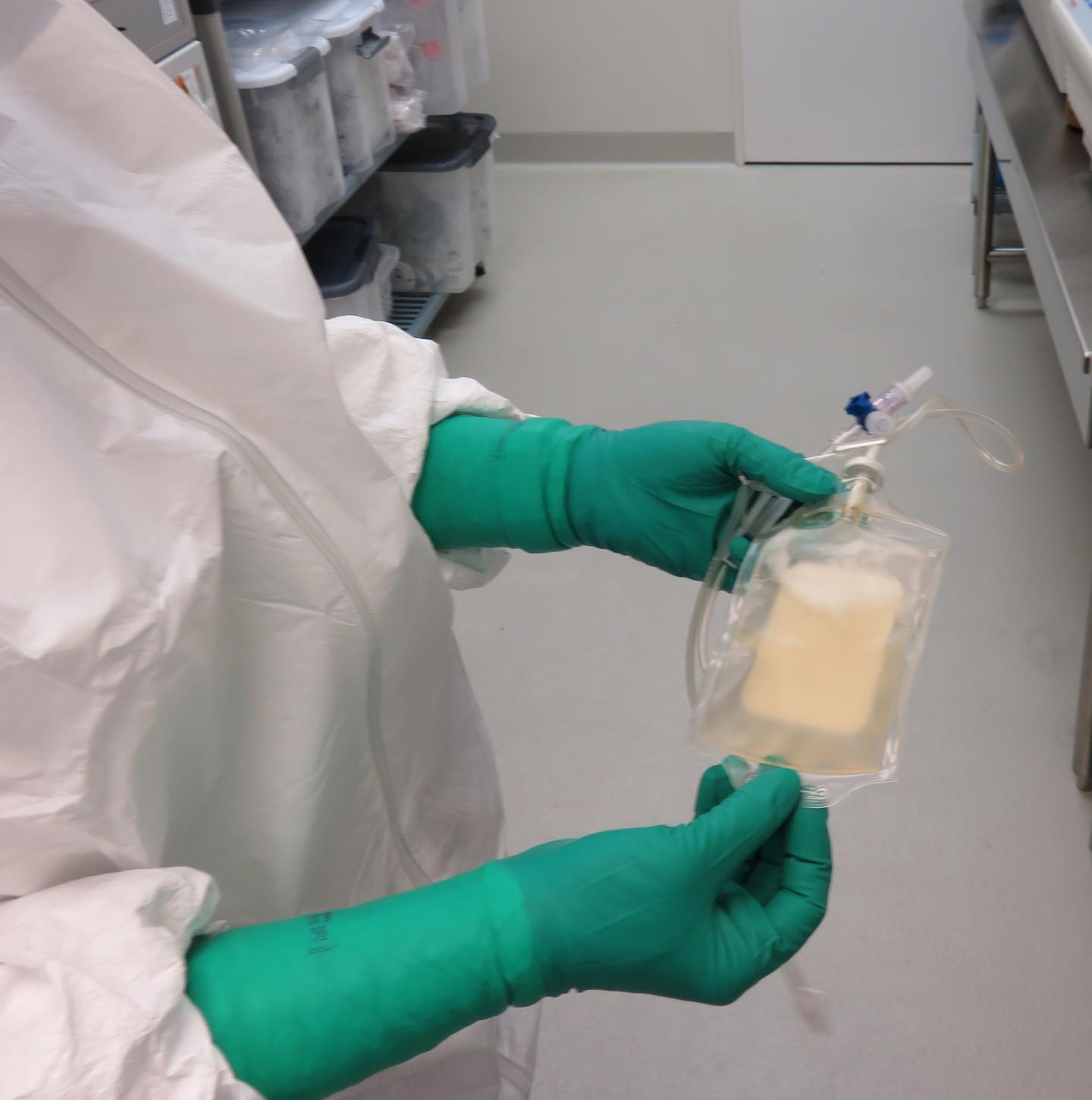 Personalized Melanoma Vaccines