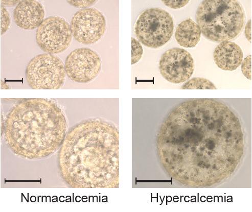 A Bioengineered Tattoo Monitors Blood Calcium Levels (1 of 3)