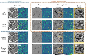 New end-to-end neural network called Fourier Imager Network (FIN) for rapid phase recovery and hologram reconstruction that achieves superior generalization to unseen sample types over the existing deep learning methods.