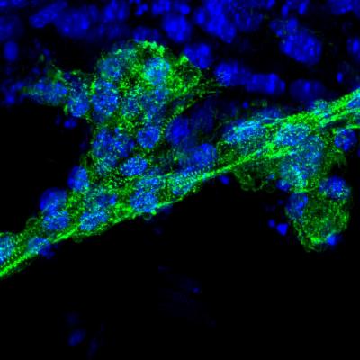 Immune fluorescence of HIP cardiomyocytes in a dish