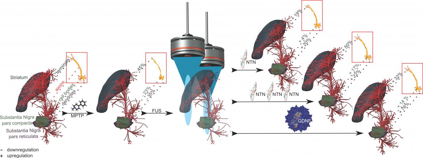 Upregulation of the Dopaminergic Pathway Following Focused Ultrasound-Facilitated Drug Delivery