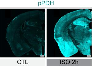 pPDH in anesthetized conditions