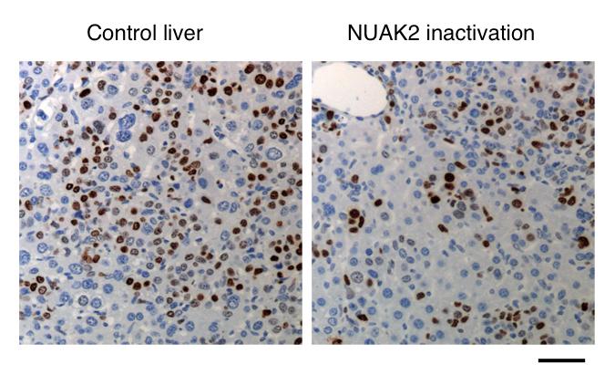 Reducing Cancer Proliferation