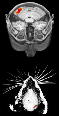 Mouse-human Brain